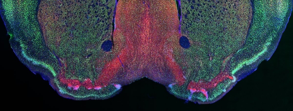 모르피우스의 눈(The Eyes of Morpheus), IBS 시냅스 뇌질환 연구단 = 그리스 신화에 등장하는 ‘모르피우스’는 잠을 결정하고 꿈을 만드는 잠의 신이다. 아직 많은 부분이 의문으로 남아있는 수면 연구를 위해 뇌의 시각교차구역을 형광으로 염색했다. 붉은 색으로 보이는 부분은 뇌의 측면 시각교차 구역이며, 활성화된 신경세포는 초록색으로, 비활성된 신경세포는 붉은 색으로 나타난다. 중앙의 두 파란 점은 세포의 핵이다.