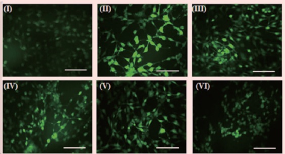 [Effect of CGA on intracellular ROS induced by UV in CCRF cells. A) DCFDA staining (I) Without UV (II) UV treated; (III) CGA 6.25 μg/ml+ UV (IV) CGA 1.25 μg/ml+ UV (V) CGA 25 μg/ml+ UV (VI) CGA 50 μg/ml+ UV]