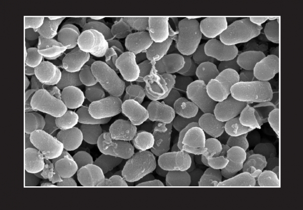 코스맥스가 세계 최초로 발견한 신규 미생물 ‘EPI-7’(정식명:Epidermidibacterium keratini). 사진은 SEM(주사전자현미경) 4만배율 촬영.