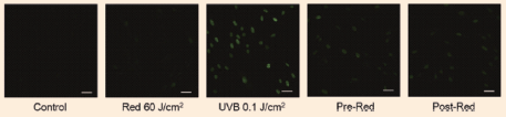 그림 2. Gamma-H2AX assay를 통한 자외선 UVB에 의한 섬유아세포의 DNA손상에 대한 적색광의 완화 효과 [17]