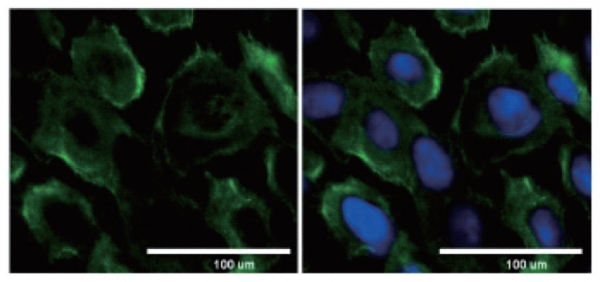 그림 4. 각질형성세포의 세포막에서 발현되는 Endogenous rhodopsin(사진 왼쪽), 과발현시킨 Recombinant rhodopsin(오른쪽) (DAPI, 파랑) [35]