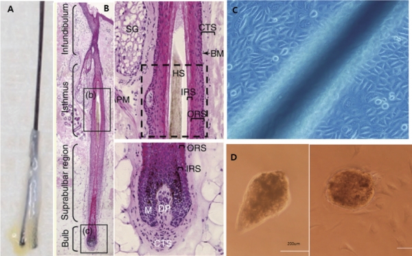 그림 3 실제 모낭 및 모낭 조직 사진과 ORS 세포와 DP 세포의 배양.A : 실제 분리된 ex-vivo 모낭.B : 모낭의 조직학적 구분(ORS : out root sheath, IRS : inner root shea th,M: matrix).C : ORS 세포 배양의 실제.D : DP(Dermal papilla) 세포 배양의 실제.