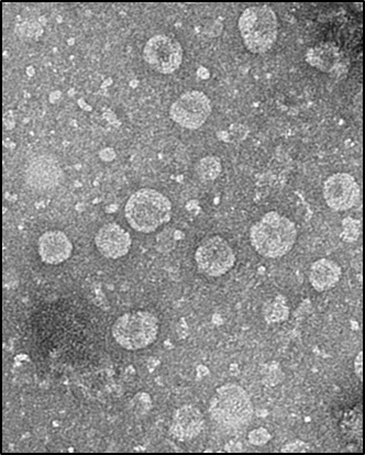 녹차유산균 엑소솜(L. plantarum exosome)을 전자현미경촬영(Bio-TEM)한 사진.