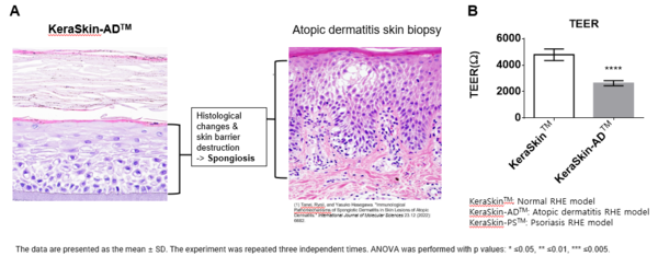 그림 1. 아토피 피부염 유사 3차원 인체조직모델의 조직학적 및 물리적 변화