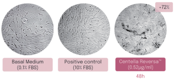 그림 2. Wound healing properties of Centella ReversaTM (in vitro)