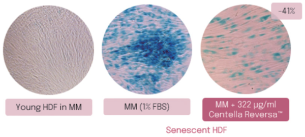 그림 3. β-Gal positive staining microscopic images of young and aged fibroblasts stained treated with Centella Reversa™.