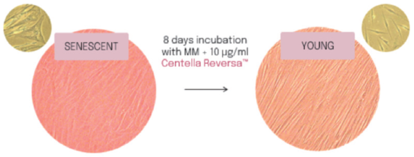 그림 4. Microscopic images of young and aged fibroblasts treated with Centella Reversa™
