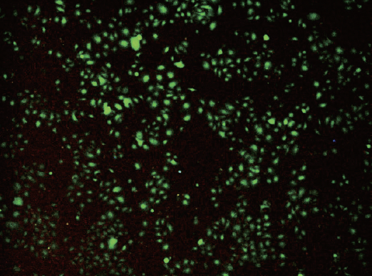 미세먼지(PM10)가 피부각질세포에 염증(녹색)을 일으킨다 ©부용출, 경북대학교