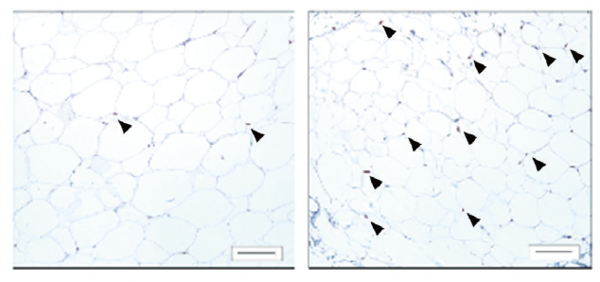 마그놀롤 처리한 피하지방세포는 분화가 촉진되었다.(PPAR:흑색) ©김미선, LG생활건강