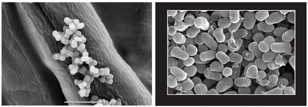 'Strain CX' 현미경 사진(왼쪽)과 코스맥스가 세계 최초로 발견한 신규 미생물 ‘EPI-7’(정식명Epidermidibacterium keratini). 사진은 SEM(주사전자현미경) 4만배율 촬영. ⓒ코스맥스