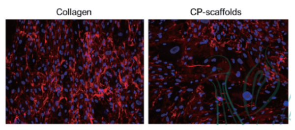 그림 4. CP-Scaffold위에서 자라는 섬유아세포의 콜라겐 생성 차이