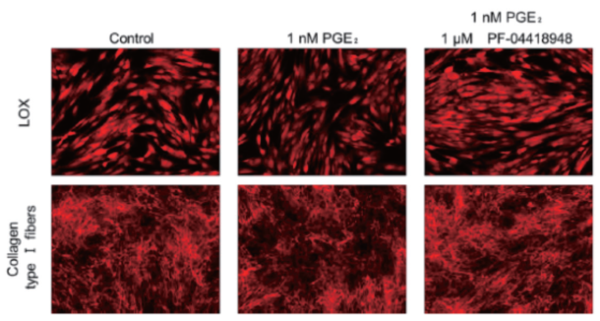 그림 5. 섬유아세포내에서 LOX와 콜라겐 섬유 형성에 대한 PGE2의 영향 비교