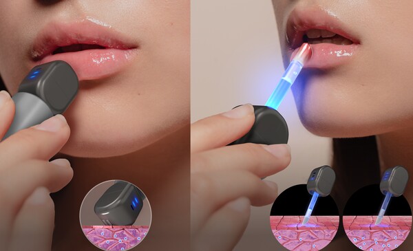 아모레퍼시픽이 개발한 '립큐어빔(Lipcure Beam)' 기술이 CES 2024  디지털 헬스(Digital Health) 부문 혁신상을 받았다 ⓒ아모레퍼시픽