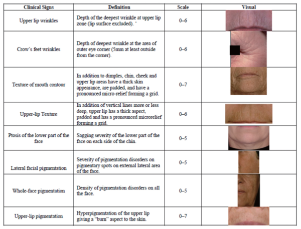 표 1. 주름 및 피부결, 안검하수 및 색소침착에 따른 안면 노화 임상 평가 기준