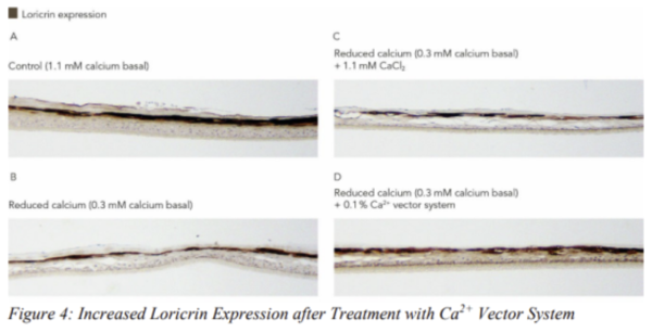 그림 5. Increased Loricrin Expression after Treatment with Ca2+ Vector System