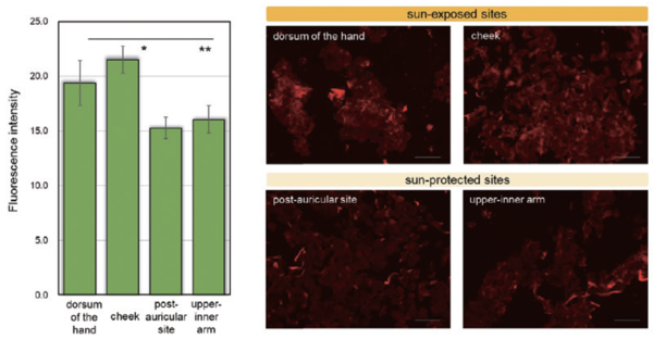 그림 1. Representative images of 3-NT visualized in corneocytes by immunostaining: differences of sunprotectedand sun-exposed skin sites. Corneocytes were collected with tape-stripping by cellotape(Nichiban, Tokyo), and were transferred to glass slides by immersion into xylene twice. Corneocytes were immuno-stained with a primary 3-N antibody(diluted 1:200) and Secondary and antibody, anti-rabbit lgG conjugated AlexaFluor594(diluted 1:200). Fluorescence images of corneocytes were obtained using a BZ-X810 All-in-One fluorescence microscope. Scale bars: 100um. The FI originating from 3-NT in fluorescence images was quantified using specialized software, corneocytometry 2. Results are presented as means ±SD, n3. Dunnett test, *p 〈0.05, ** p〈 0.01